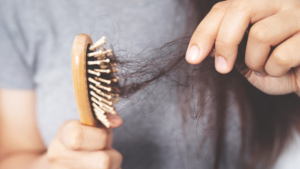 queda de cabelo